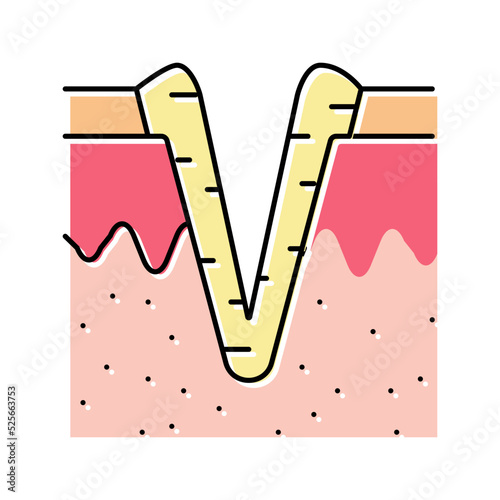 ice pick acne scar color icon vector illustration
