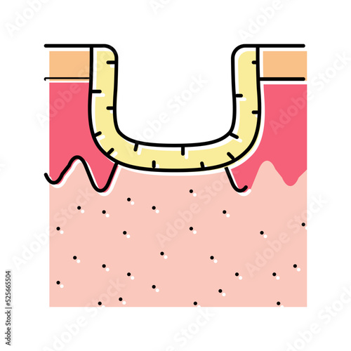 hypertrophic acne scar color icon vector illustration