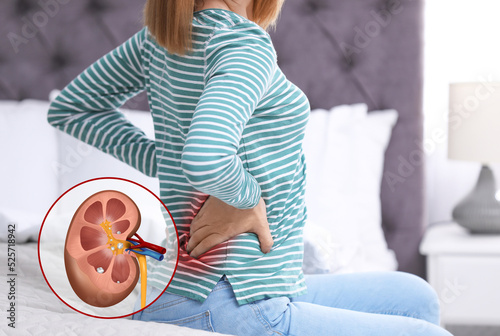Bild auf Leinwand Woman suffering from pain because of kidney stones disease at home