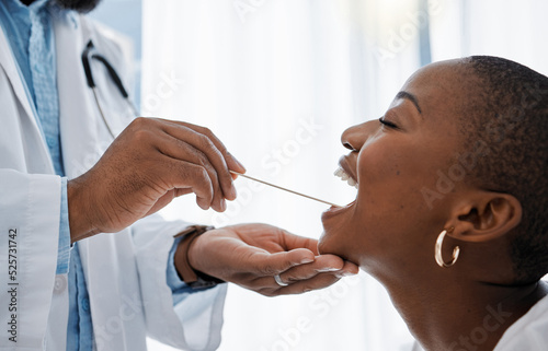 Doctor, otolaryngologist or dentist with a medical instrument checking the throat for tonsils or oral cancer. Health, healthcare worker and wellness with an ent specialist examining a black woman