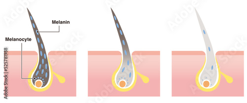 Cross section of black hair turn to gray. Vector illustration isolated on white background.