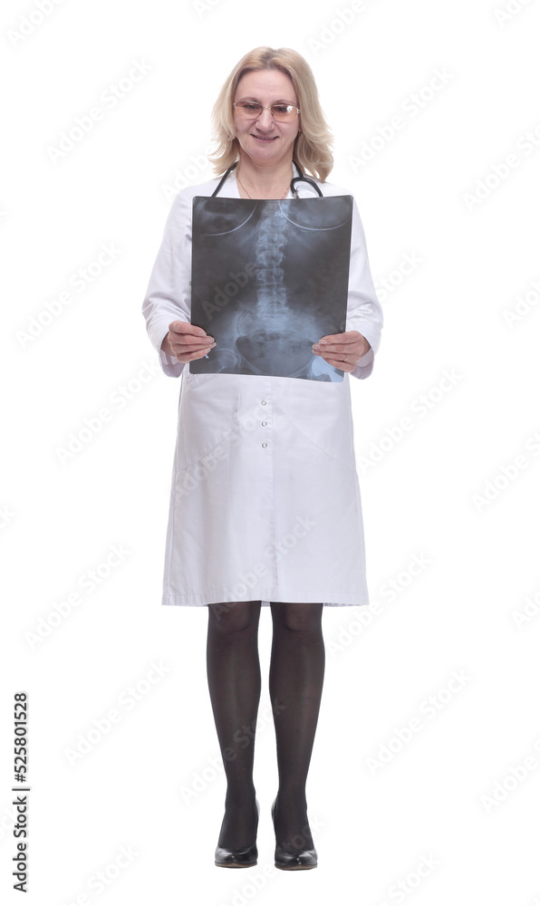 x-ray in the hands of a female therapist . isolated on a white x-ray in the hands of a female therapist . isolated on a white