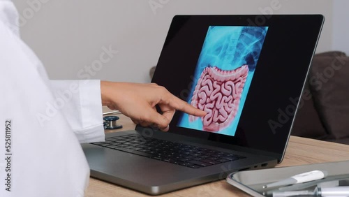 Woman Doctor showing x-ray of stomach and intestine on a laptop. Slow motion