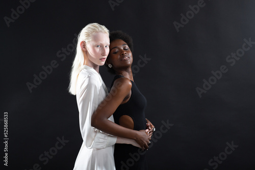 Caucasian albino girl and african american young woman hugging on black background. Women friendship, love and relationships concept. LGBT pride.