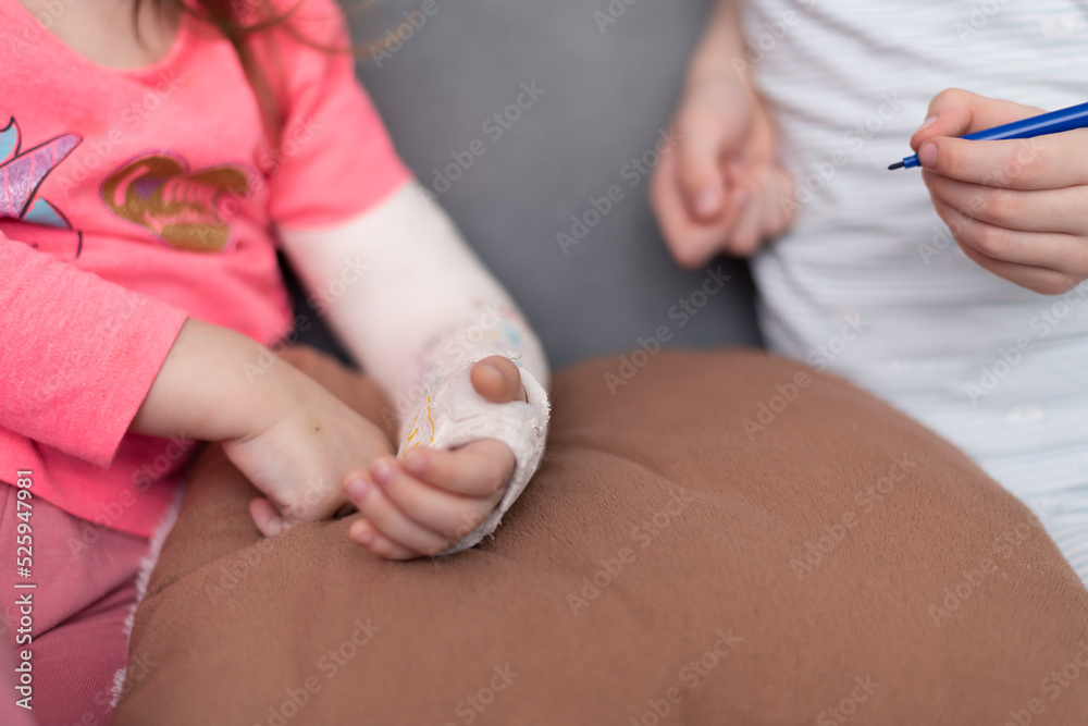 River fracture in a child. Brother and sister draw on plaster, bandages. River fracture in a child. Brother and sister draw on plaster, bandages.