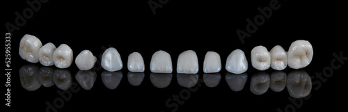 dental job photography, crowns veneers implants 