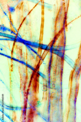 Abstract micrograph (maniuplated) of peat moss leaves, with polarization.