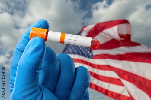 hand holding test collection tubes on monkeypox virus test positive results with United States - USA flag.