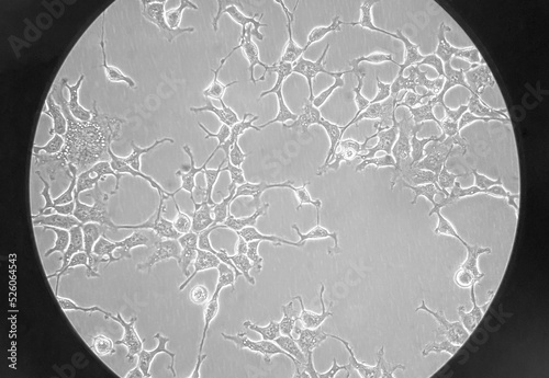 HEK-293 cells cultured in a DMEM medium. The cells are extensively exploited in receptor signaling, cancer research, and large-scale protein production. photo