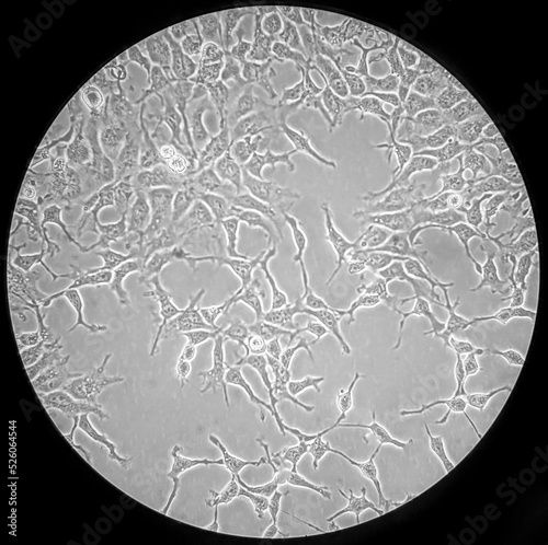 The HEK293 cells consisting of immortalized human embryonic kidney cells. It is one of the most widely used cell lines in research. Phase microscopy image. 