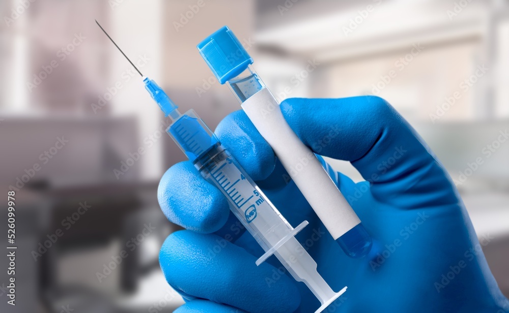 Medical laboratory assistant checks a test tube. Reproductive system