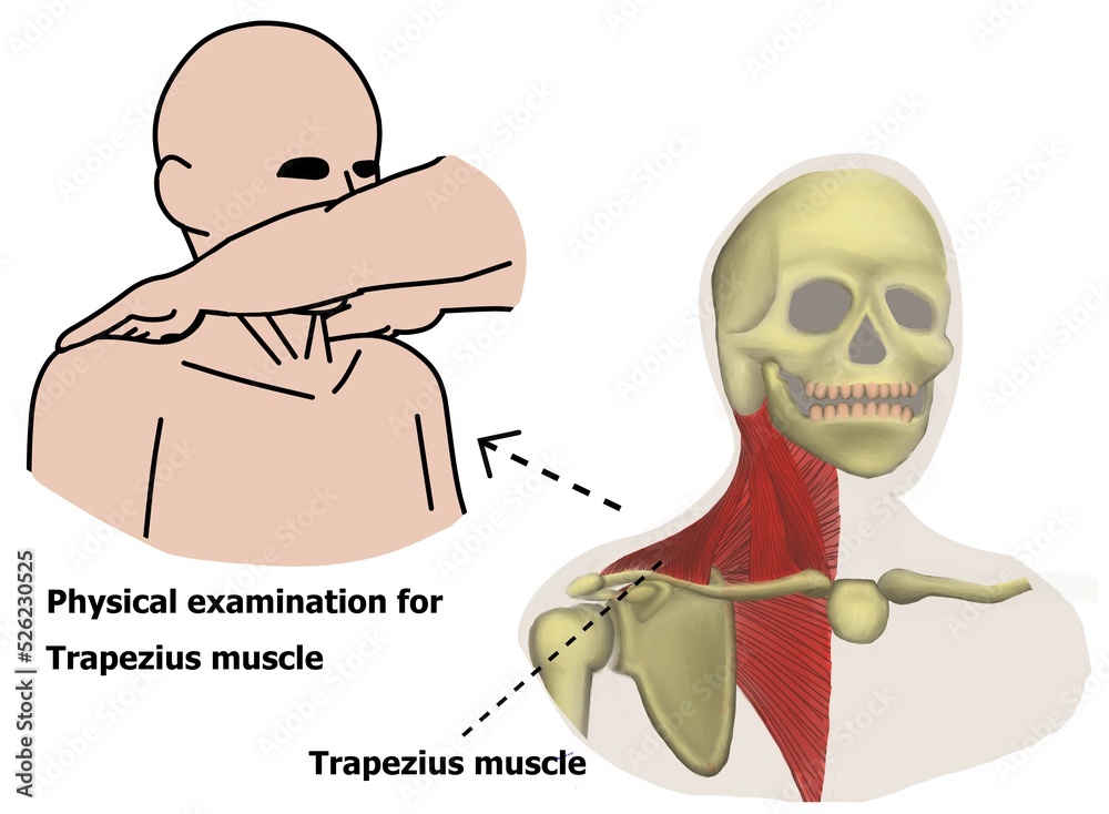 The physical examination of cranial nerve 11th via trapezius and