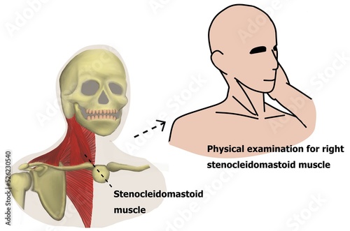 The physical examination of cranial nerve 11th via trapezius and sternocleidomastoid muscles power testing.