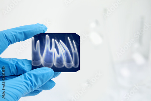 Doctor holding X-ray picture of teeth indoors, closeup. Space for text