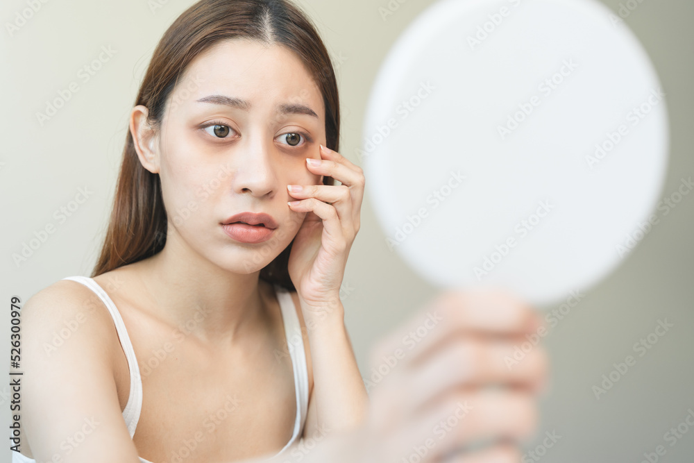 lack of sleep problem, Worried Asian young woman pointing finger at dark circles under her eyes lack of sleep problem, Worried Asian young woman pointing finger at dark circles under her eyes