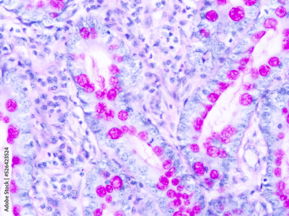 Histology of human tissue, show  epithelial tissue and connective tissue with microscope view  from laboratory (not Illustration Designation)