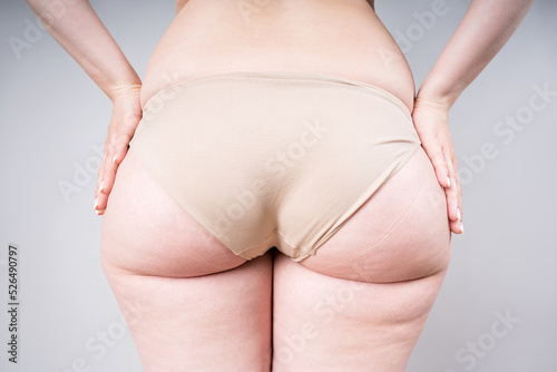 Overweight thigh, woman with fat hips and buttocks, obesity female body with cellulite on gray background