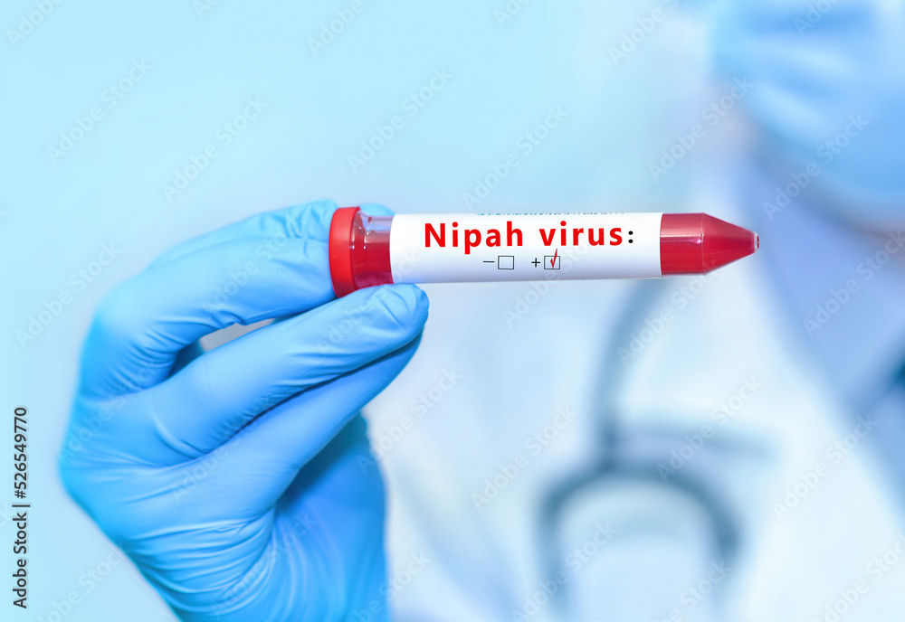 Doctor holding a test blood sample tube with positive Nipah.The virus is transmitted from animals to humans or through contaminated food, it can also be transmitted directly from person to person Doctor holding a test blood sample tube with positive Nipah.The virus is transmitted from animals to humans or through contaminated food, it can also be transmitted directly from person to person