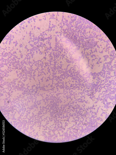 
Microbiological fixed spherical lactic acid bacteria stained purple with gentian violet under a microscope photo