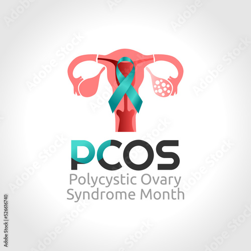 vector graphic of polycystic Ovarian Syndrome Month good for polycystic Ovarian Syndrome Month celebration. flat design. flyer design.flat illustration. photo