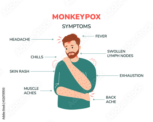 A man with monkeypox and the symptoms illustration. Fever, headache, swollen lymph node, rashes on face, body and back, muscle aches. For awareness in spreading of orthopoxvirus outbreak.