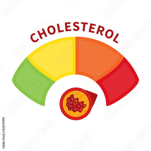 Cholesterol level on blocked blood vessel medical diagram. Meter gauge of ldl and hdl lipoprotein. High and low fat test indicator. Atherosclerosis risk. Healthcare concept. Vector illustration.