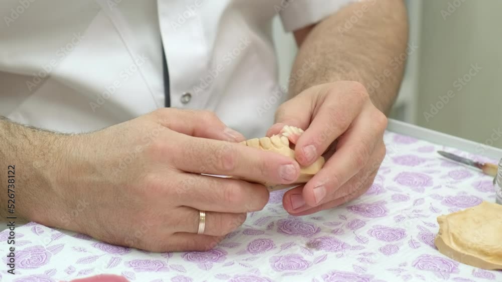 Dental technician examining gypsum plaster cast of jaws and removable dentures Dental technician examining gypsum plaster cast of jaws and removable dentures