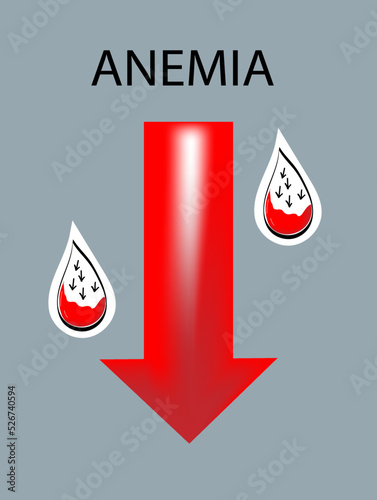 Anemia concept.  Low hemoglobin content. Vector doodle illustration.