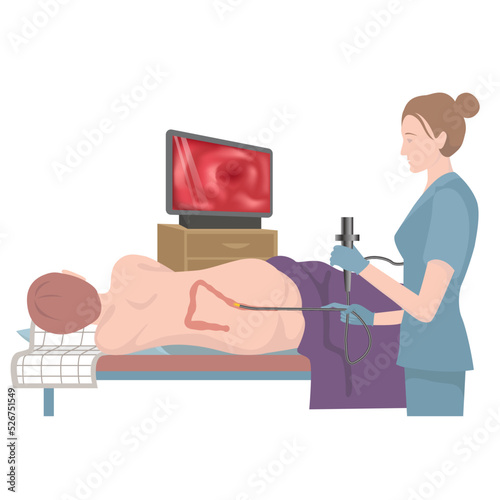 Sigmoscopy. Examination of the intestines with the help of the introduction of an endoscope through the anus. Doctor with a patient. Medical poster. Vector flat illustration photo