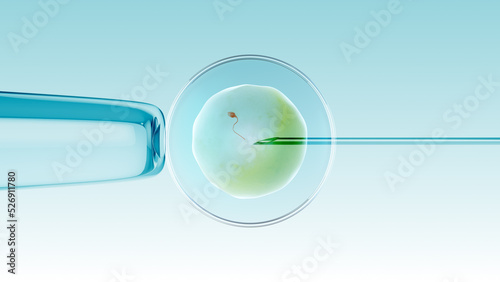 Wallpaper Mural  Ivf in vitro fertilization of an egg with a sperm Torontodigital.ca