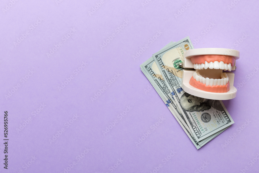 Closeup model of a human jaw with white teeth and dollar bill ...