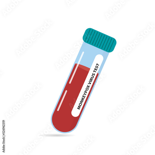 A test tube with a blood sample for testing for monkeypox virus and viral cells. Microbiological medical data.Vector illustration