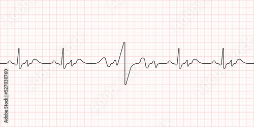 Electrocardiogram. Heart beat. Medical healthcare symbol