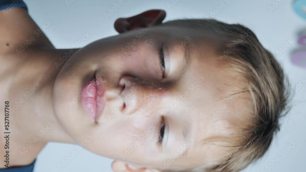 scratching his nose with a finger with the symptom of atopic dermatitis on the nose and white