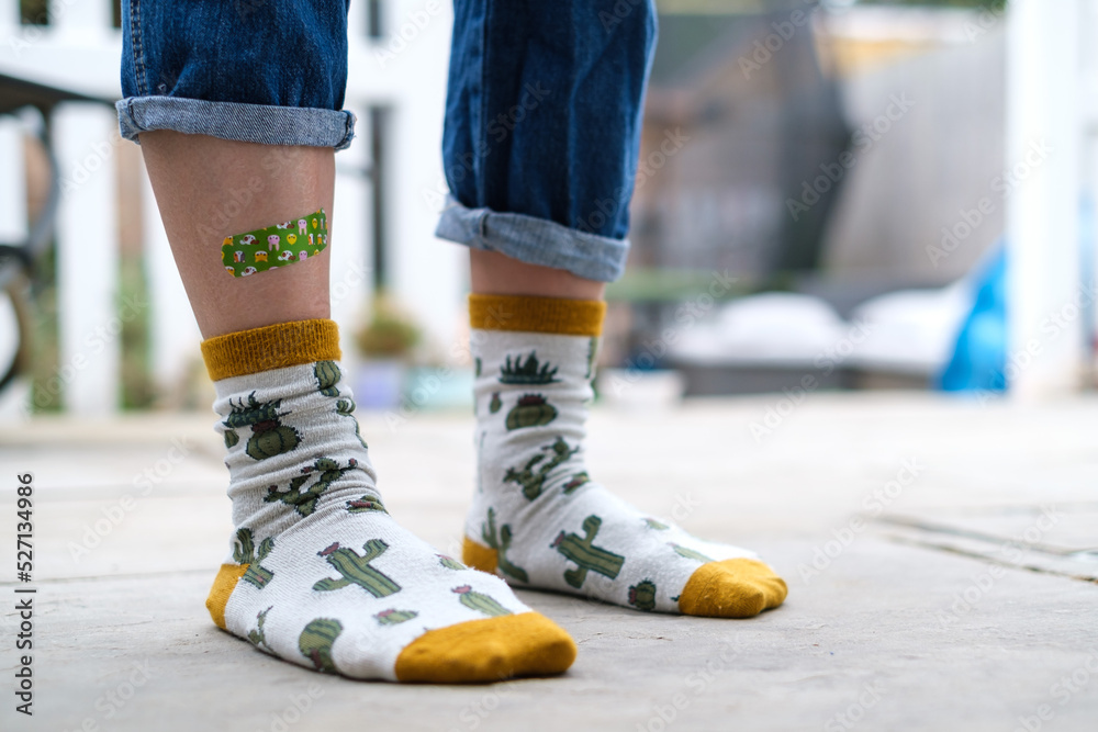 Girl legs with a plaster wearing socks with printed cactus