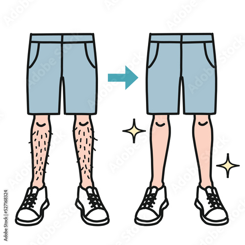 すね毛が生えている足と脱毛してスッキリした足　男性美容