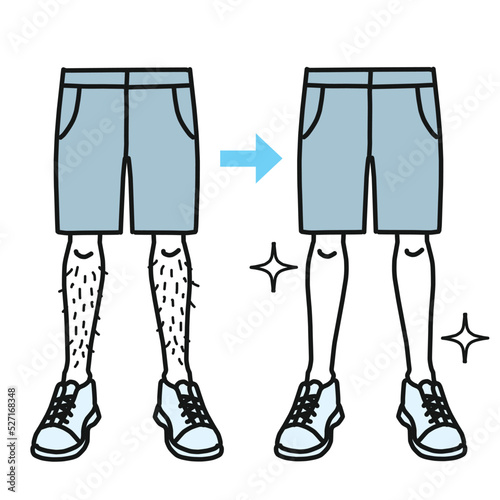 すね毛が生えている足と脱毛してスッキリした足　男性美容