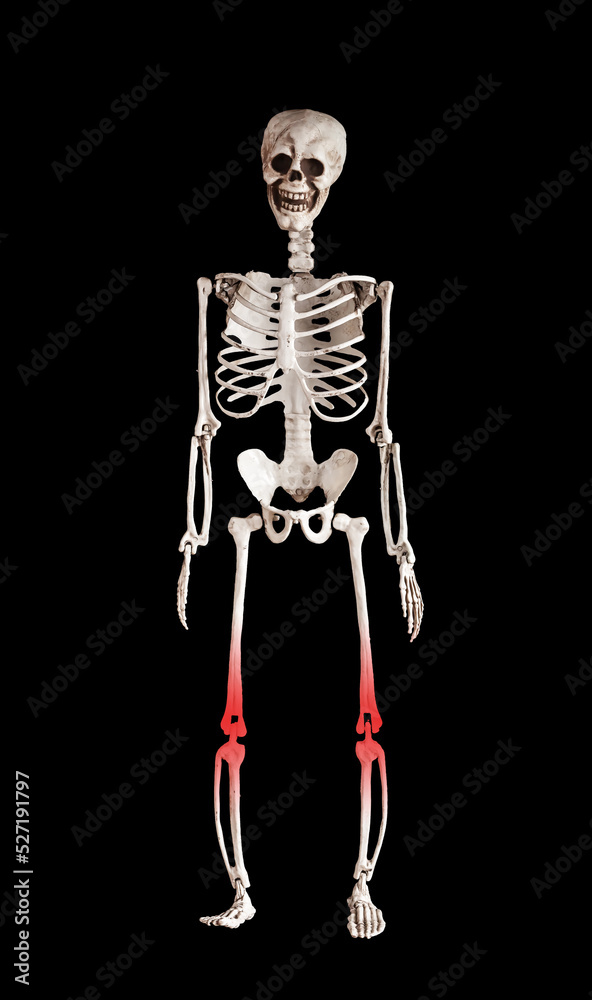 Human skeleton with red knees. Leg pain caused by overuse, injury. Painful kneecap, muscle strain. Health problems, medical conditions concept. Human skeleton with red knees. Leg pain caused by overuse, injury. Painful kneecap, muscle strain. Health problems, medical conditions concept.