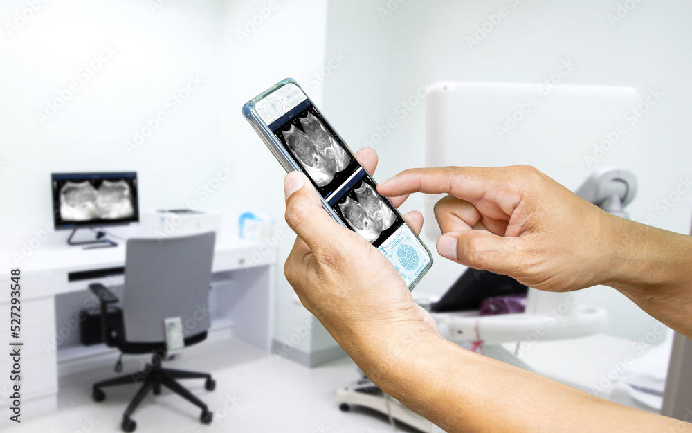 Close-up hand uses smartphone to check ultrasound abdomen online, Modern medical equipment. An ultrasound machine and a couch,Medical technology concept. Close-up hand uses smartphone to check ultrasound abdomen online, Modern medical equipment. An ultrasound machine and a couch,Medical technology concept.