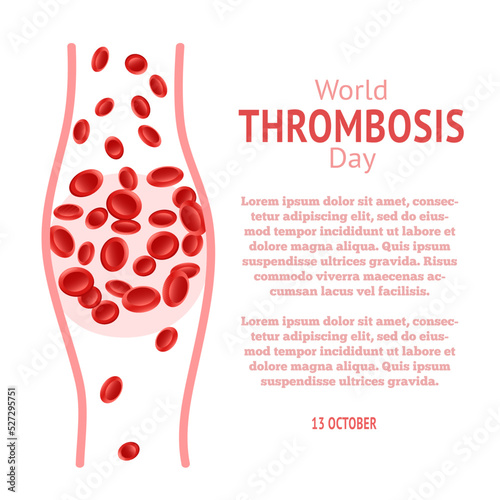 World Thrombosis Day 13 October. Design vector illustration with Thrombosis symbol photo