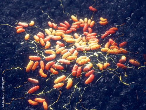 Obraz na plátně Plague is an infectious disease caused by Yersinia pestis bacteria