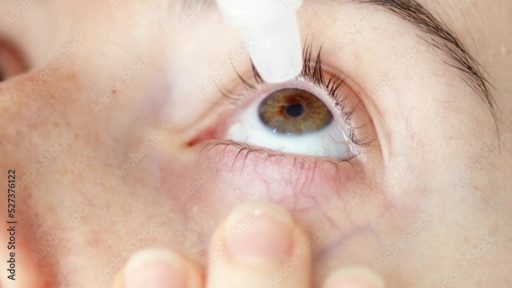 Closeup girl drops eye drops install lenses, moisturizing, using