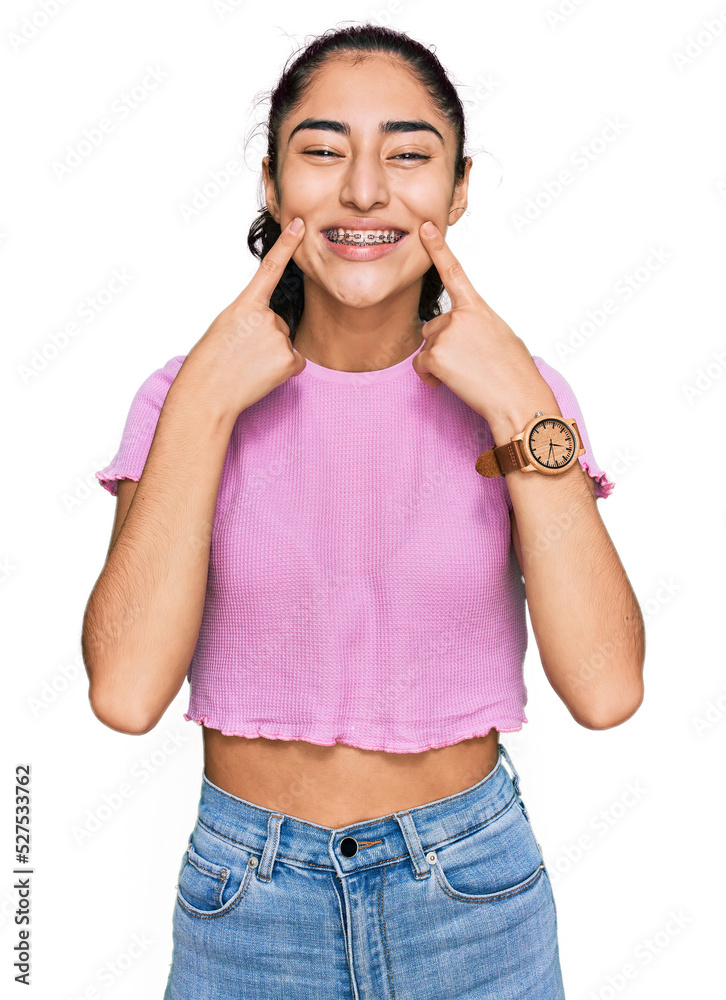 © Krakenimages.com - Hispanic teenager girl with dental braces wearing casual clothes smiling with open mouth, fingers pointing and forcing cheerful smile