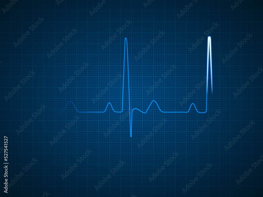 Blue ECG EKG Diagram of a Healthy Heart Blue ECG EKG Diagram of a Healthy Heart
