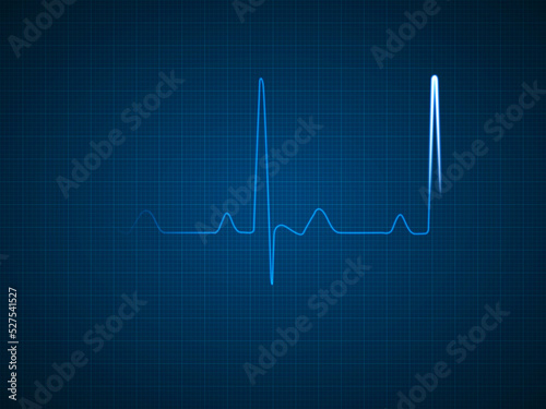 Blue ECG EKG Diagram of a Healthy Heart