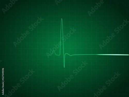 Green ECG EKG Diagram of a Flatline Patience photo