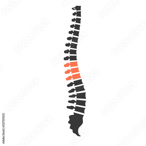 Back ache. Human spine. Mid back ache.