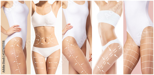 Female body with the drawing arrows on it. Fat lose, liposuction and cellulite removal concept.