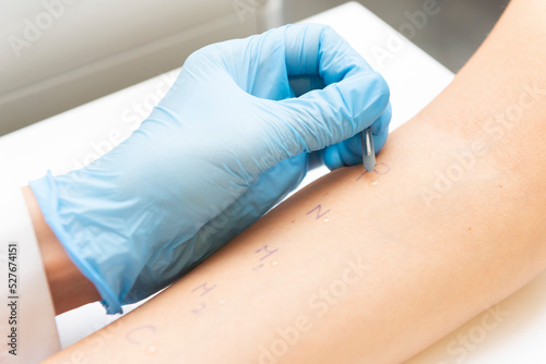 doctor doing allergy test to her patient, skin prick test at her patient in medical office