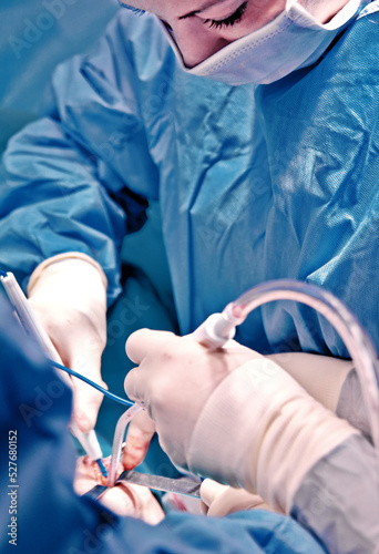 Surgeon and his assistant performing cosmetic surgery in hospital operating room. Surgeon in mask wearing loupes during medical procadure. Breast augmentation, enlargement, enhancement, breast cancer